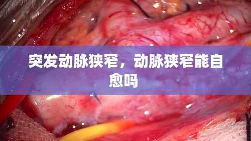 突发动脉狭窄,动脉狭窄能自愈吗