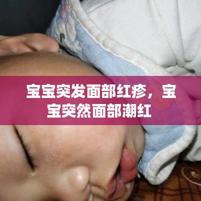宝宝突发面部红疹,宝宝突然面部潮红