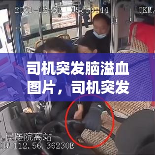 司机突发脑溢血图片,司机突发脑出血雇主有责任吗?走法律我要陪多少钱