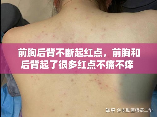 前胸后背不断起红点，前胸和后背起了很多红点不痛不痒 